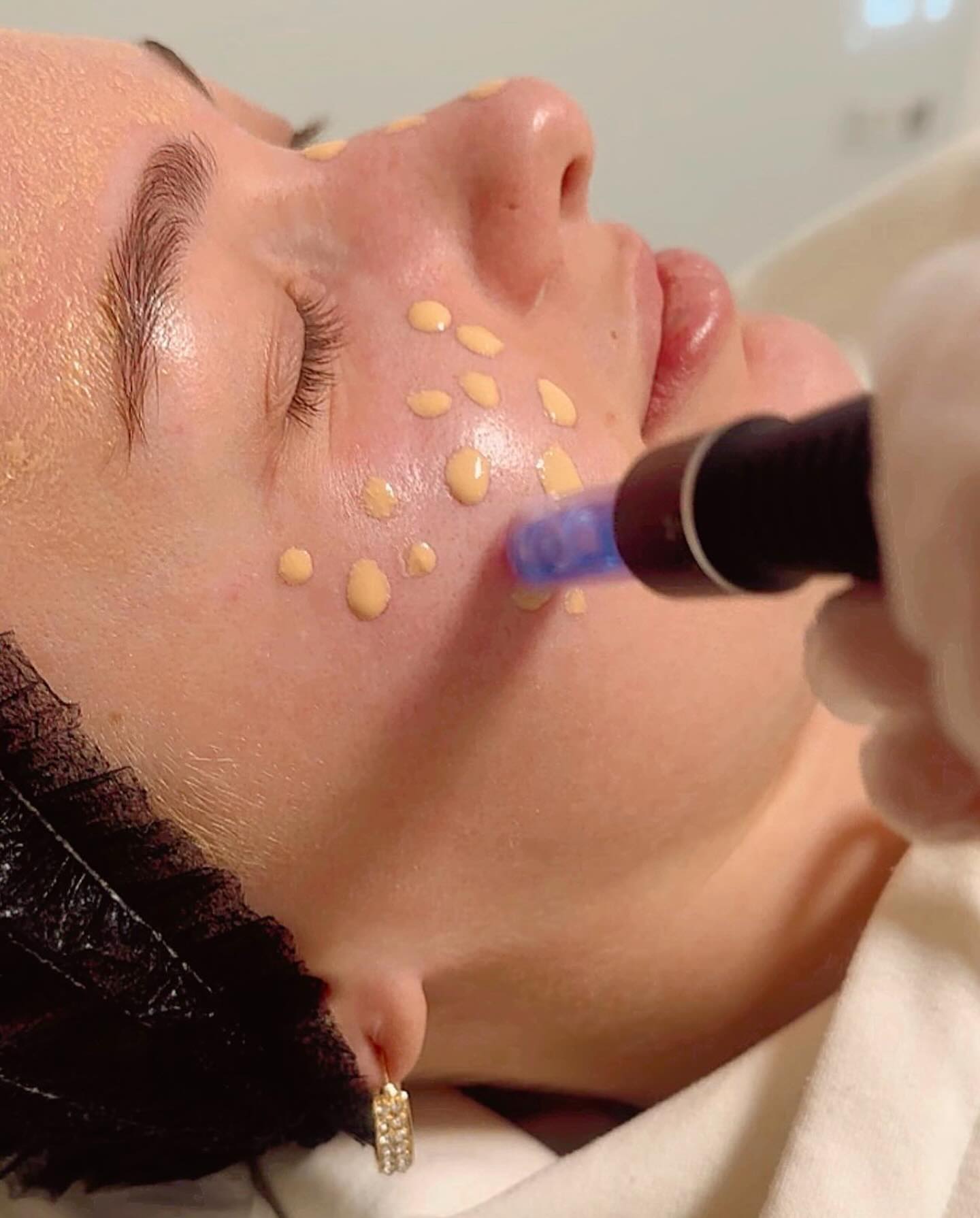 BB Glow vor der Hochzeit: Was du wissen musst
